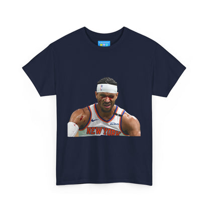 Josh Hart bleeding