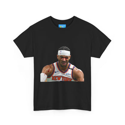 Josh Hart bleeding